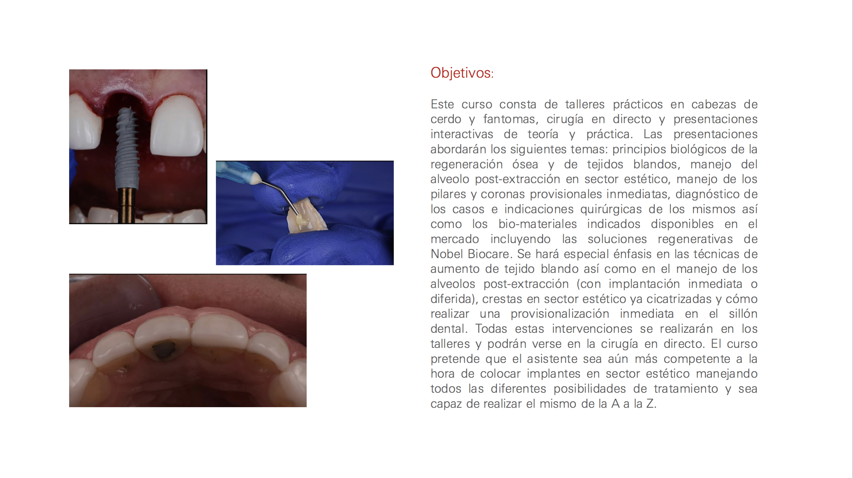 curso-formacion-implantes-clinica-dental-alberto-fernandez-ayora-almeria