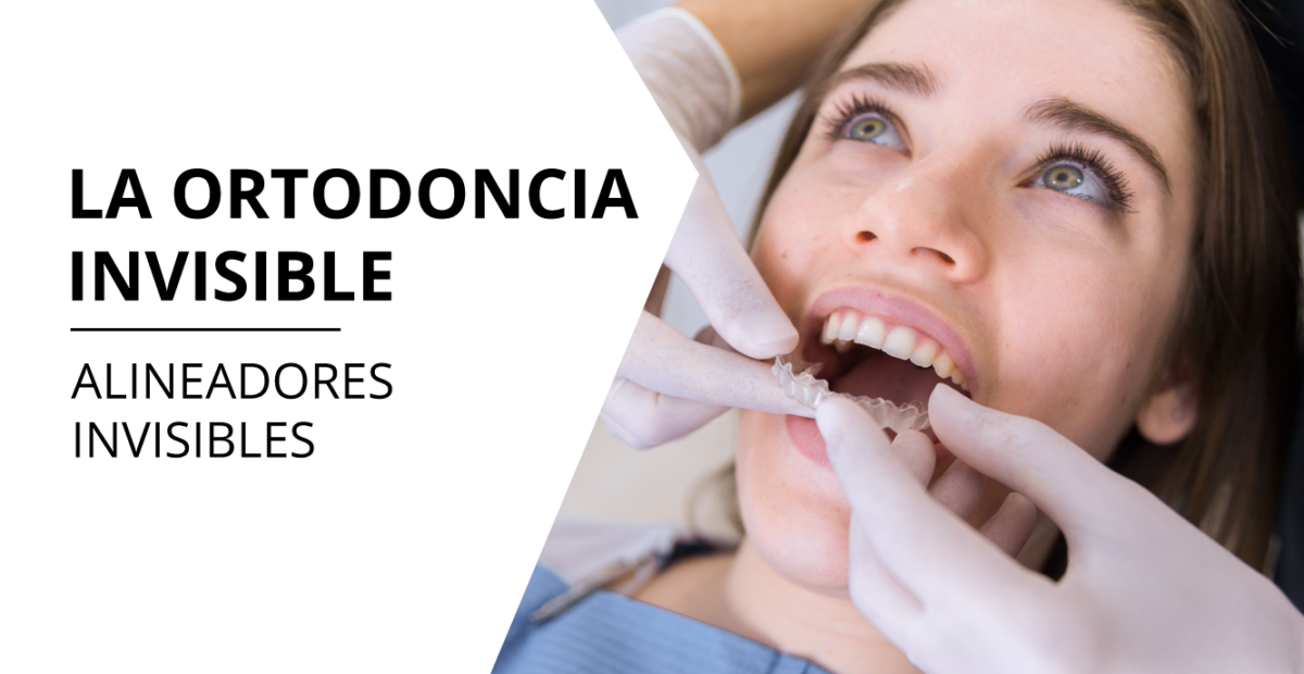 Ortodoncia Invisible Clínica Dental Fernández And Ayora 