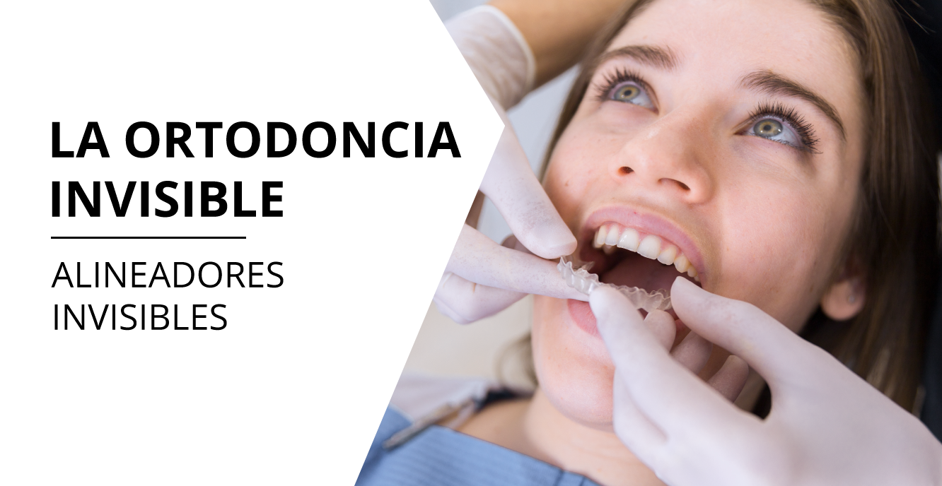 La ortodoncia invisible en Clínica Fernández y Ayora en Almería